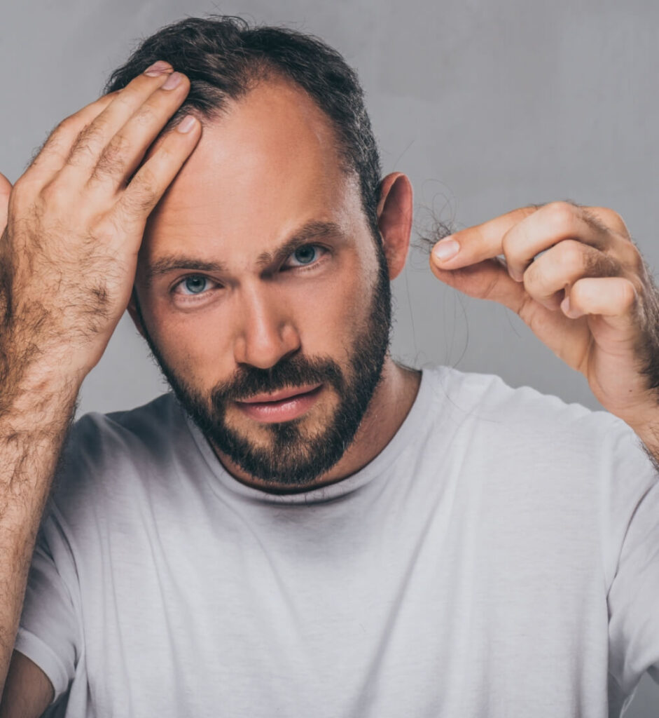 bearded-middle-aged-man-holding-fallen-hair-and-lo-2024-11-17-09-22-03-utc (1)